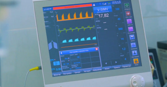 EKG – Elektrokardiogram